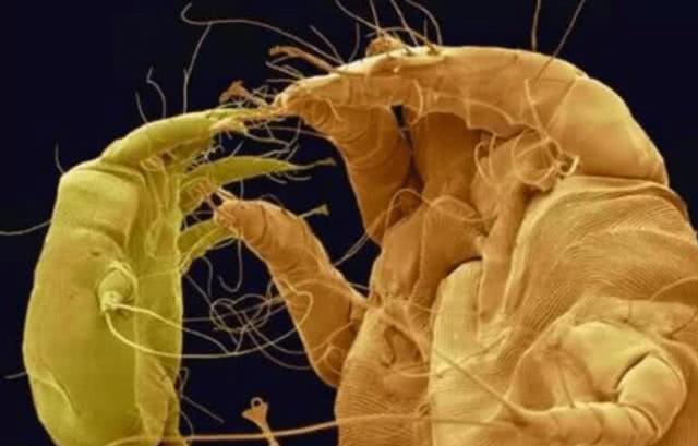 3000倍显微镜下的寄生虫，你知道它们像什么吗？