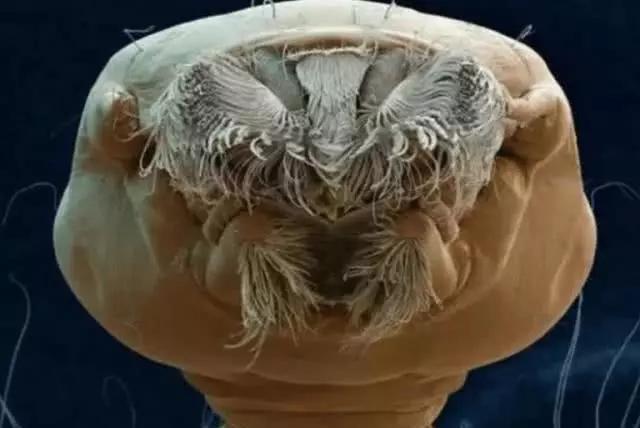 3000倍显微镜下的寄生虫，你知道它们像什么吗？