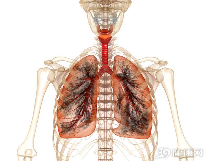 肺癌喜欢"缠上"3类人，排第一的不是烟民，在家中就可能中招