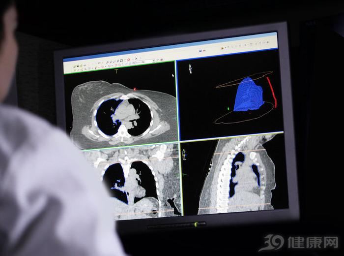 21岁女孩确诊肺癌晚期，5天后离世，化疗、手术都来不及