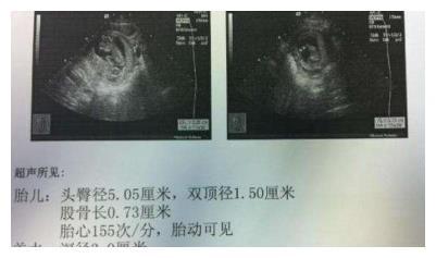 孕期不同阶段B超单信息，关乎胎儿健康，你都知道吗？