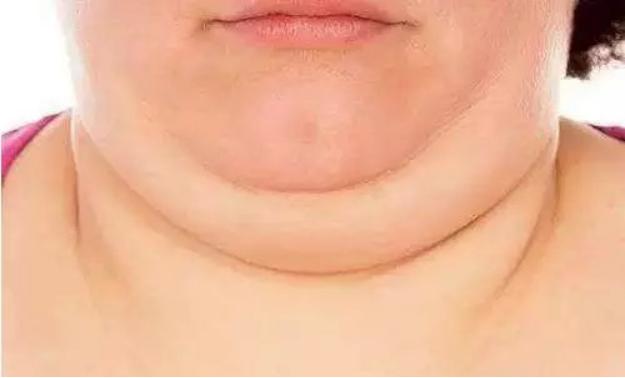 脖子粗寿命短?研究表明:这是真的!