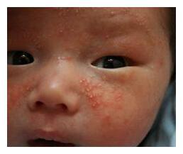 宝宝冬季皮肤问题多，主要是这生活中7类东西在伤娃