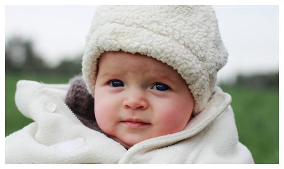 宝宝冬季皮肤问题多，主要是这生活中7类东西在伤娃