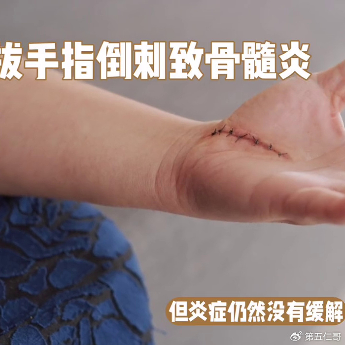 民间流传:老虎舔一口,半边脸没有,是真的吗?...