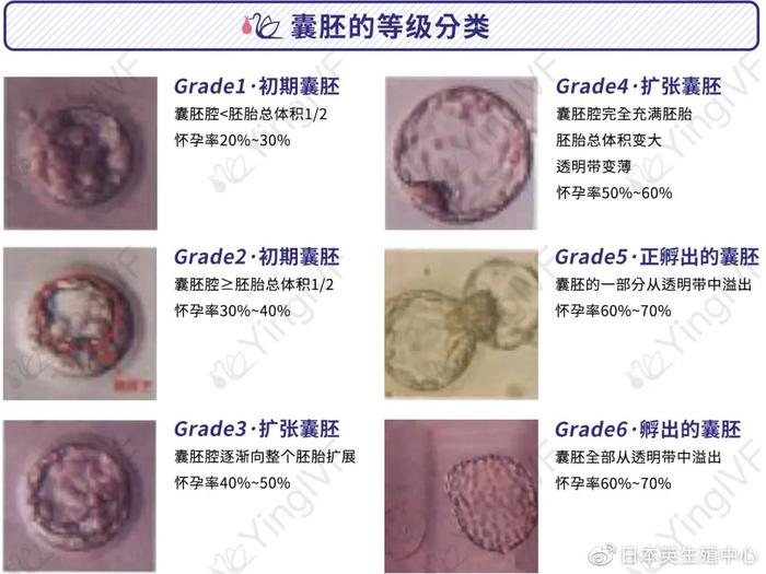 关于囊胚级别，看这一篇就够！| 英科技