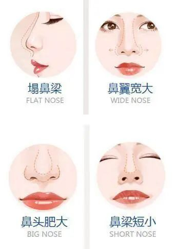 怎么样能变上镜 w700d1q75cms.jpg?by=cms_fixed_width