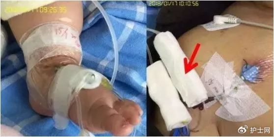 为什么输液要盖块纱布留置针肝素帽取下后,你还打算继续使用吗?_新闻资讯_第3张_活检穿刺产品网 为什么输液要盖块纱布留置针肝素帽取下后,你还打算继续使用吗?_https://www.jmylbn.com_新闻资讯_第3张