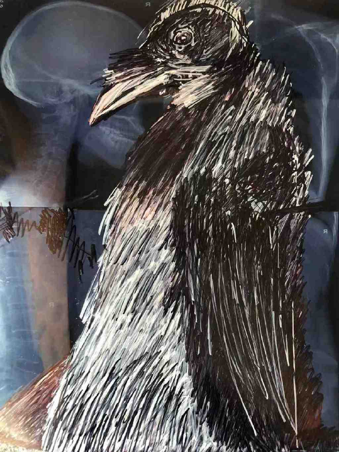 x光材质怎么调九丹：用画笔在人体X光片上探索灵魂_https://www.jmylbn.com_新闻资讯_第6张
