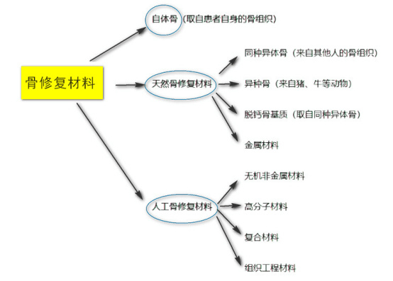 异体骨有哪些品牌骨填充修复材料知识精华大揭秘：分类、特点、价格、集采全知晓！_https://www.jmylbn.com_新闻资讯_第4张