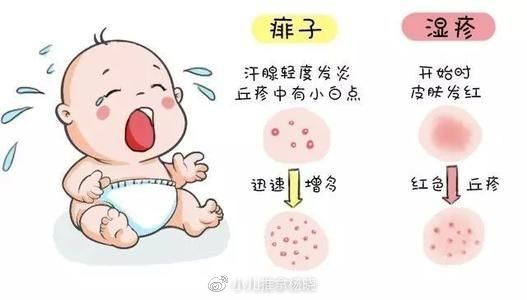 疤不得怎么用小儿推拿杨晓:夏天宝宝长痱子怎么办?如何预防护理?常见哪些误区_新闻资讯_第7张_活检穿刺产品网 疤不得怎么用小儿推拿杨晓:夏天宝宝长痱子怎么办?如何预防护理?常见哪些误区_https://www.jmylbn.com_新闻资讯_第7张