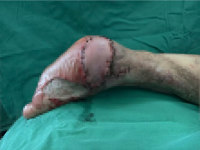 保定徐水:人社局认定工伤 获赔百万后被工地方起诉不当得利(图5)