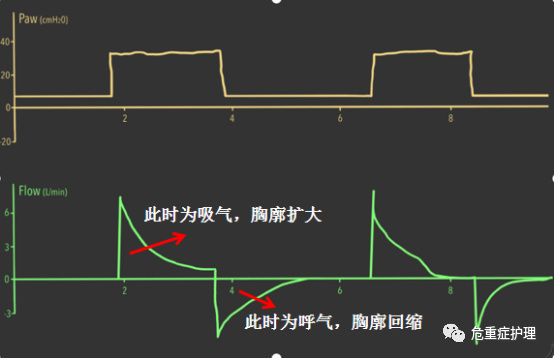 呼吸机胀气怎么排气管插管误入食道，如何判断你知道吗？_https://www.jmylbn.com_新闻资讯_第4张