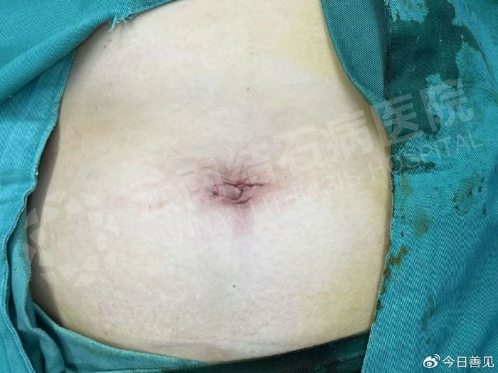 w700d1q75cms.jpg?by=cms_fixed_width