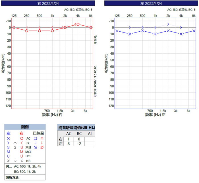 听力下降常见原因 如何保护耳朵健康