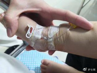 动脉留置针怎么输液刚扎好的留置针怎么拔了?静脉穿刺误入动脉_新闻资讯_第5张_活检穿刺产品网 动脉留置针怎么输液刚扎好的留置针怎么拔了?静脉穿刺误入动脉_https://www.jmylbn.com_新闻资讯_第5张