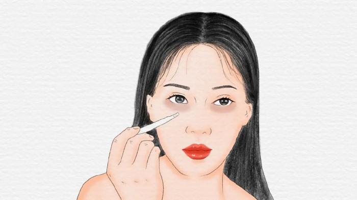 还在为黑眼圈而烦恼吗？黑眼圈也是分种类的，你是属于哪一种？（黑眼圈的三种类型）