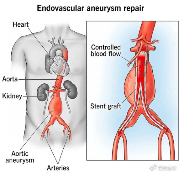 w700d1q75cms.jpg?by=cms_fixed_width