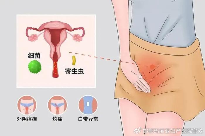 10个女性9个“炎”，远离妇科炎症，从正确认识它开始~(图1)