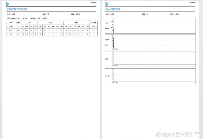 家用心电图机怎么样乐普Lepod Pro家用心电仪:心电图检测,家庭也能专业_新闻资讯_第15张_活检穿刺产品网 家用心电图机怎么样乐普Lepod Pro家用心电仪:心电图检测,家庭也能专业_https://www.jmylbn.com_新闻资讯_第15张