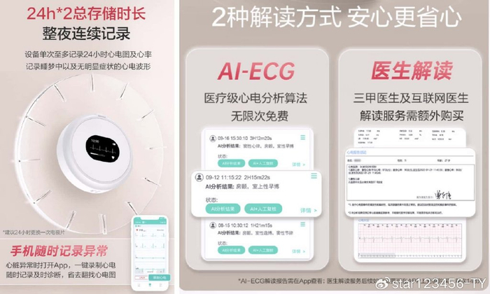 家用心电图机怎么样乐普Lepod Pro家用心电仪:心电图检测,家庭也能专业_新闻资讯_第12张_活检穿刺产品网 家用心电图机怎么样乐普Lepod Pro家用心电仪:心电图检测,家庭也能专业_https://www.jmylbn.com_新闻资讯_第12张