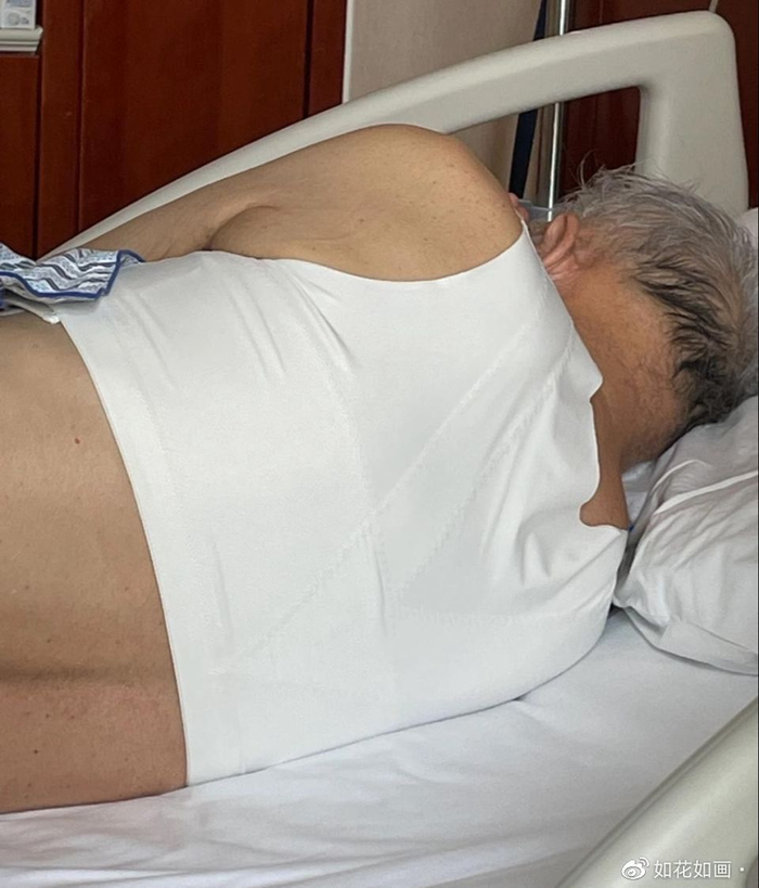 医用胸腹带怎么带关于腹带的误区：为什么它不适合胸部固定？_https://www.jmylbn.com_新闻资讯_第5张