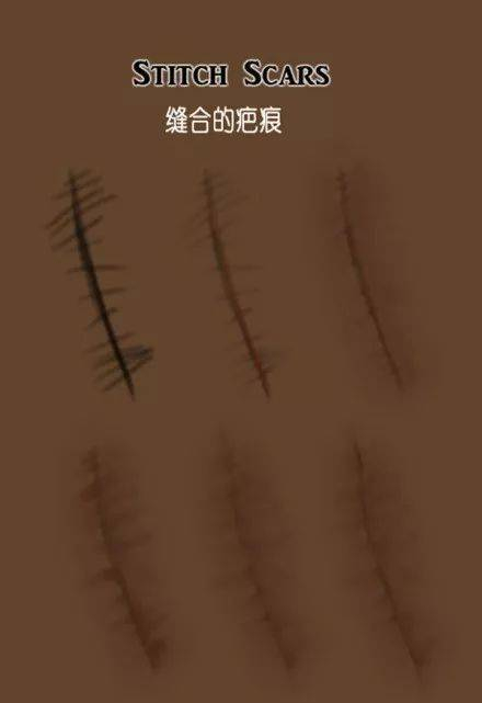 怎么简单的画一个伤疤 w700d1q75cms.jpg