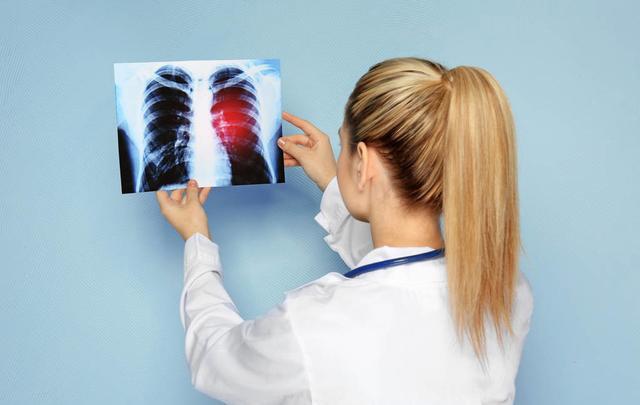 肺癌患者为什么会咳出那么多痰液，有肿瘤的原因，也有感染的因素