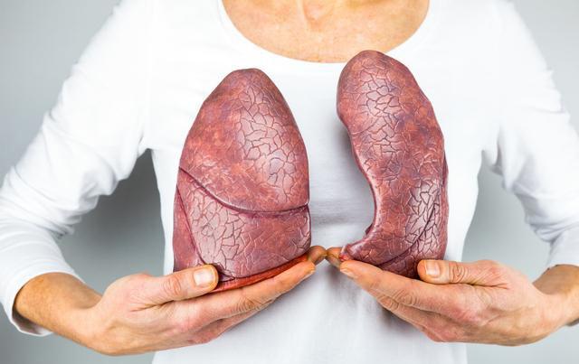 肺癌症状多种多样，常被误诊为其他疾病，有些连petct都查不出