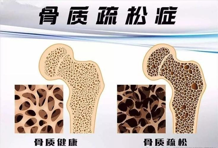 水洗蛋白怎么测医生提醒:请停止食用“水洗蛋”,或比喝酒伤肝,有人还不当回事_新闻资讯_第4张_活检穿刺产品网 水洗蛋白怎么测医生提醒:请停止食用“水洗蛋”,或比喝酒伤肝,有人还不当回事_https://www.jmylbn.com_新闻资讯_第4张