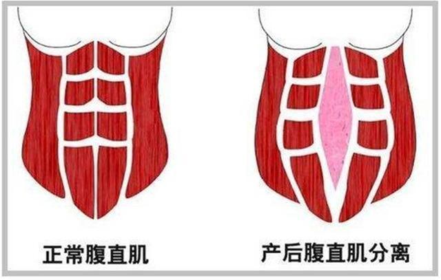 章子怡被拍到双手扶腰、小腹凸起，再怀三胎？本人发动态否认