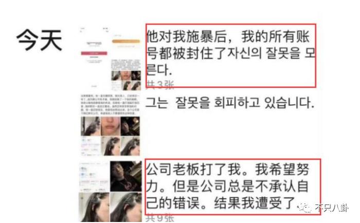 自曝被打不能工作 没人同情还挨骂 长这么好看为何大家不喜欢她?