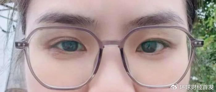 瞳距不同有什么影响,瞳距不同有什么影响吗