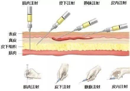 乙肝创新药RNA干扰类与沉默全病毒基因产物