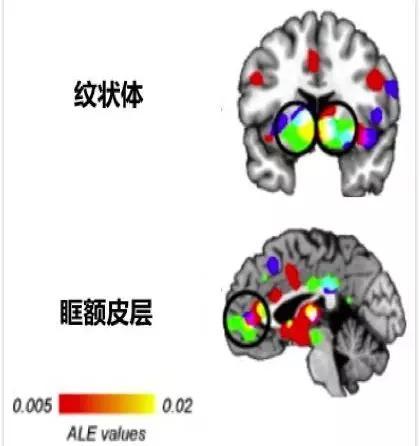 被音乐洗脑时，你的脑子里都发生了什么？