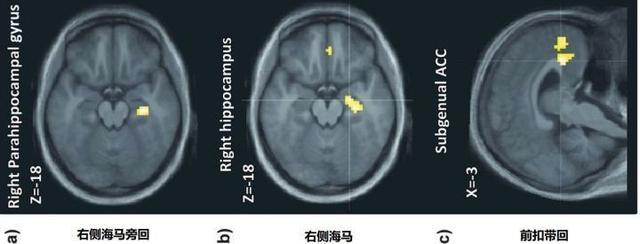 被音乐洗脑时，你的脑子里都发生了什么？