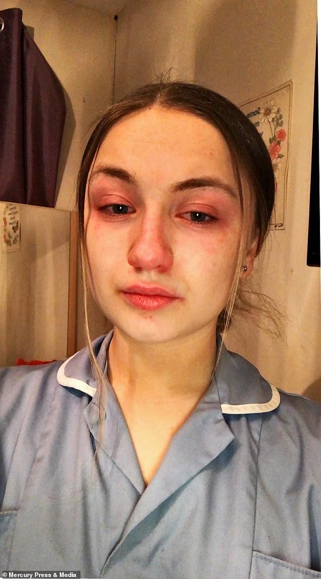 英19岁美女医助高强度工作13小时，发含泪自拍照警告：只会更糟