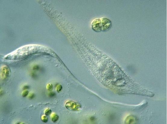 谁说单细胞生物很微小？这些单细胞生物大到超乎你的想象