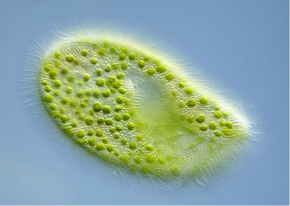 人们以为单细胞生物很弱小，实际上有一种单细胞生物大到难以形容