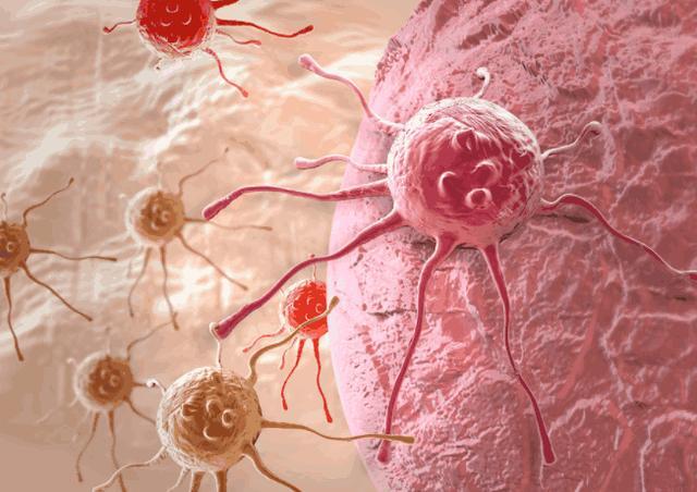 科学家研发出一种新型治疗癌症方法，效果颇佳，可彻底杀死癌细胞