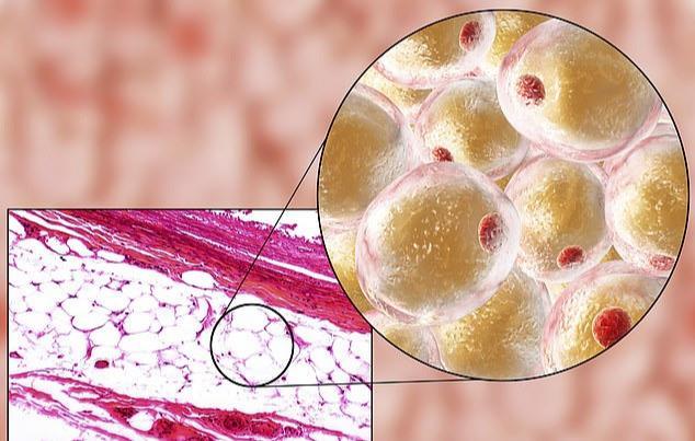 德国专家：胖子更易死于新冠，脂肪产生的蛋白质利于病毒渗入人体