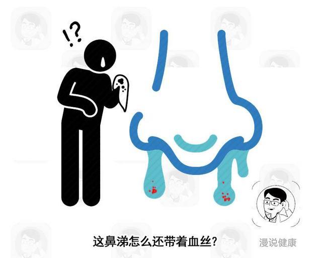 2亿中国人遭受“过敏性鼻炎”折磨！支招：做好3件事，能有效缓解