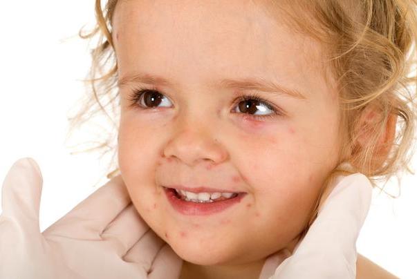 婴幼儿常见的5种皮疹，宝宝到底是哪种？家长如何分辨？
