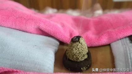 艾灸温阳有余，能否滋阴？隔中药灸可以弥补艾灸的局限性