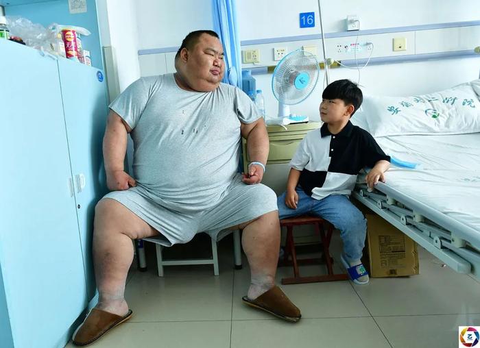 小伙1.71米高重达450斤，姑娘见了都躲，无奈到医院割胃减肥