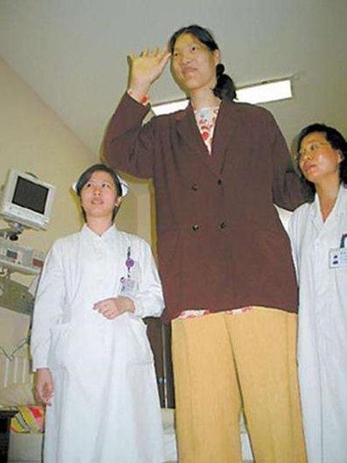 他从小患有侏儒症，去世时身高达2.41米，怎么长到这么高的？