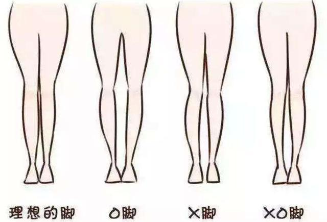 O型腿的女生怎么穿才显瘦？学会下面几点小知识，轻松修饰腿型