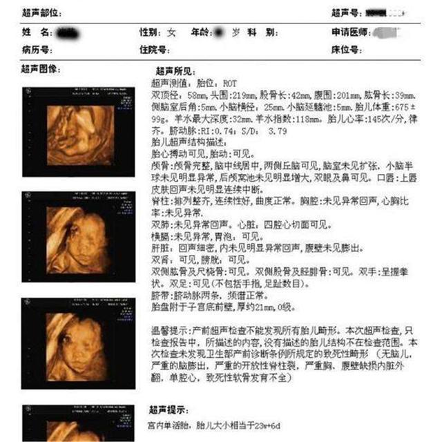 孕期B超检查次数有要求，若检查少了，小心错过干预异常的时机