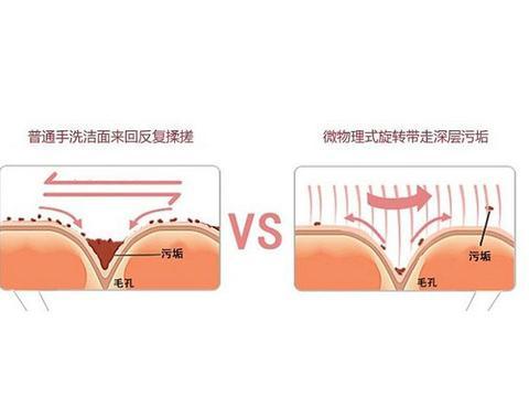 脸色暗沉粗糙，应该去角质？