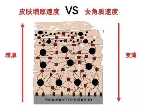 脸色暗沉粗糙，应该去角质？